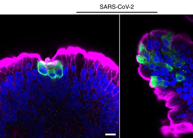 Вирусный белок нуклеокапсида (зеленый) в клетках искусственных кишечников в культуре (синий - ядра, розовый - актиновые филаменты), фото: Nature Medicine