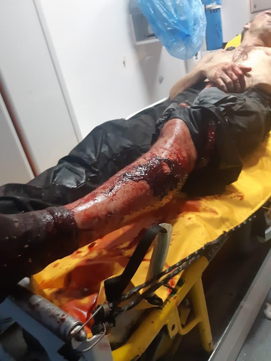 Новые фото и подробности нападения под Харьковом