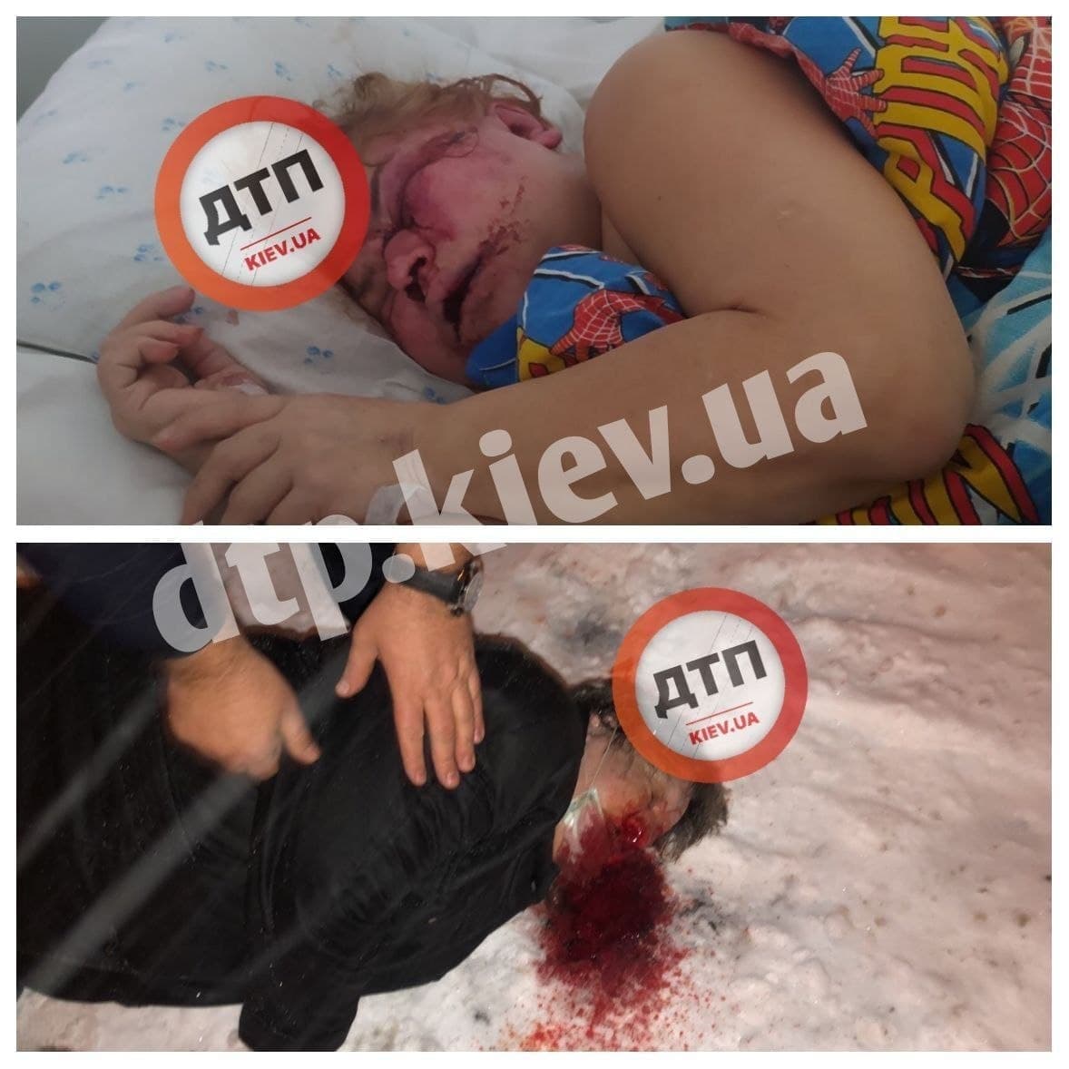 Во вторник, 1 февраля, в Киеве группа хулиганов избила пожилых женщин