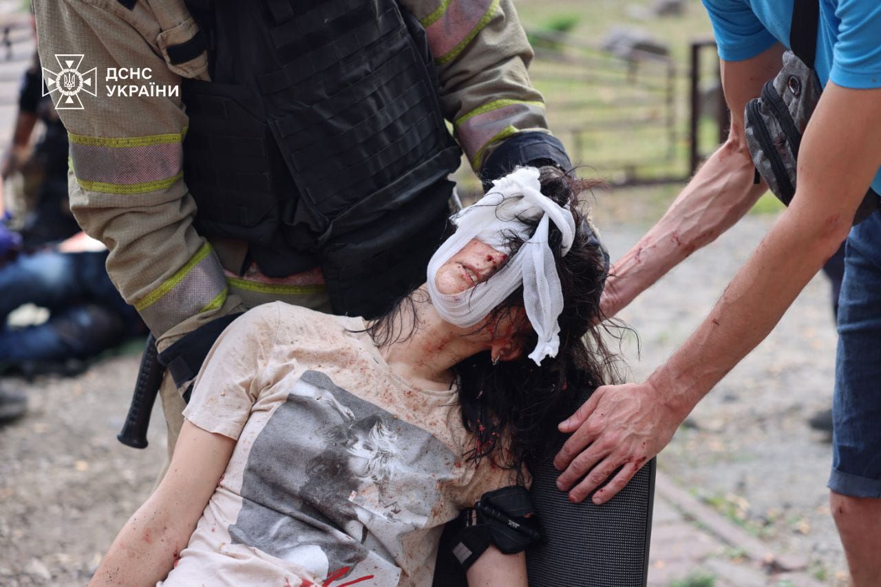 Фото пострадавшей. Источник - facebook.com/DSNS.GOV.UA/