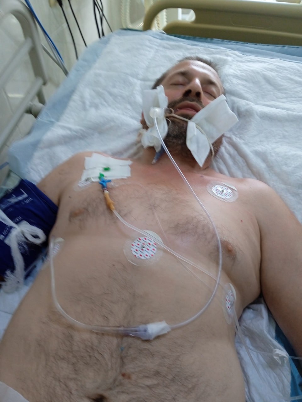 Фото госпитализированного после мобилизации