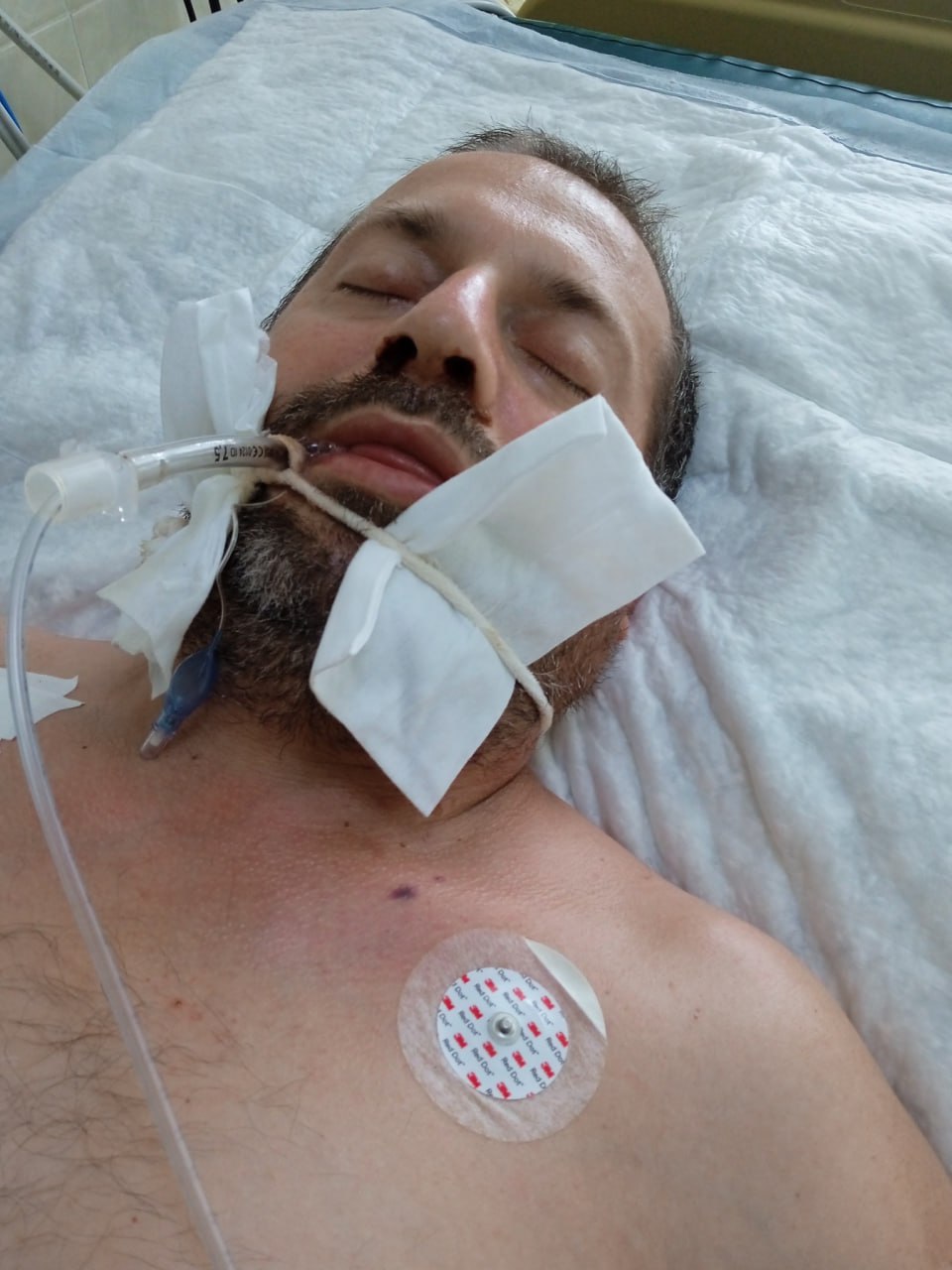 Фото (2) госпитализированного после мобилизации